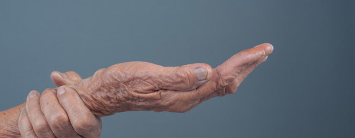Dolores en las articulaciones la edad o algo mas